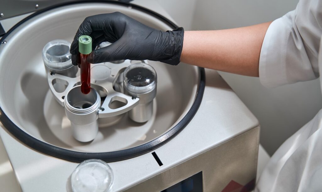 Platelet Rich Plasma
