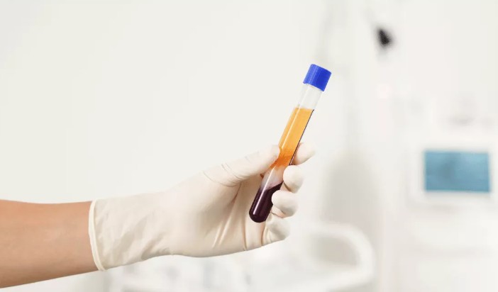 platelet rich plasma therapy