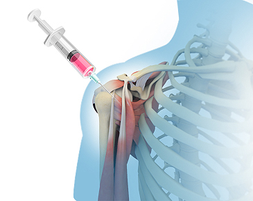 Stem Cell Therapy in North Carolina